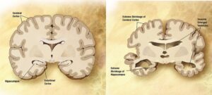 contribution of NeuronBank